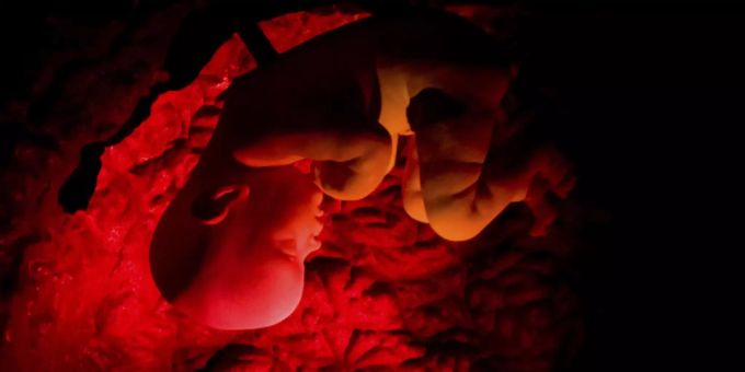 Abtreibung in Ungarn Frauen müssen sich Embryo Herztöne anhören