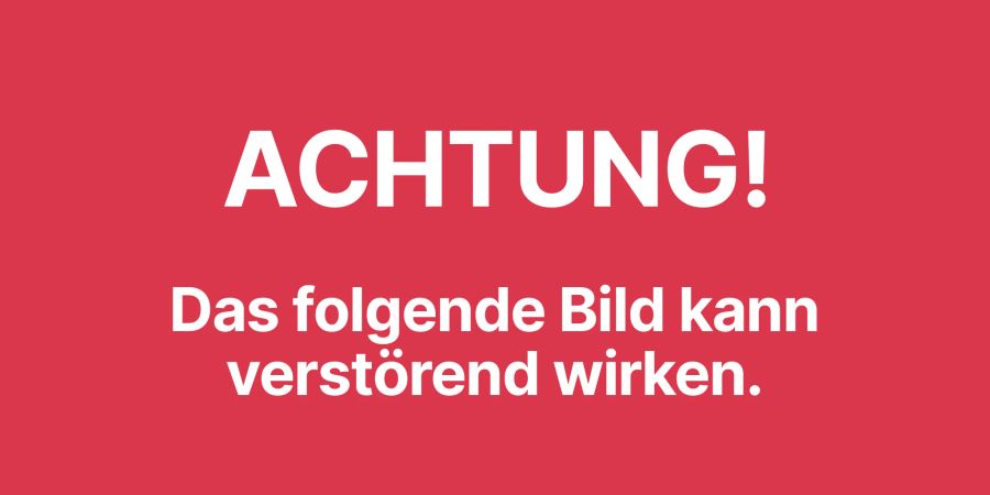 Inhaltswarnung! Das folgende Bild kann verstörend wirken.