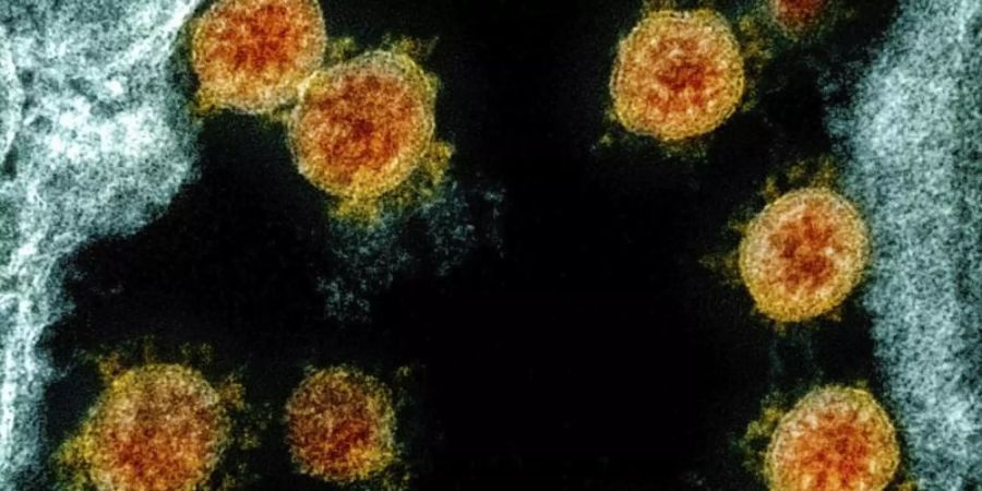 Experten gehen davon aus, dass wir das Coronavirus Sars-CoV-2 nicht wieder loswerden. Foto: Uncredited/NIAID/NIH/dpa