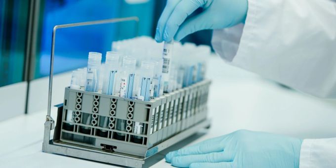 Ein Mitarbeiter bereitet in einem Coronatest-Labor PCR-Teströhrchen vor. PCR-Test BAG