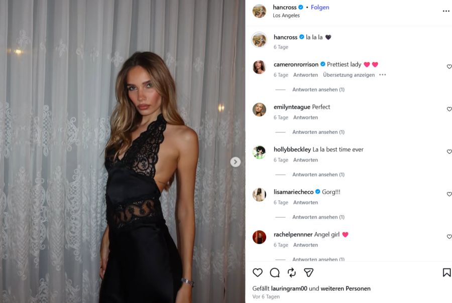 Das Model blickt nur ungern auf diese Zeit zurück – sie habe ihr «viel Angst gemacht».