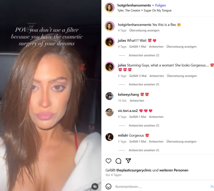 Die Influencerin brauche dank ihrer Traum-OP keine Filter mehr für Ihre Videos.