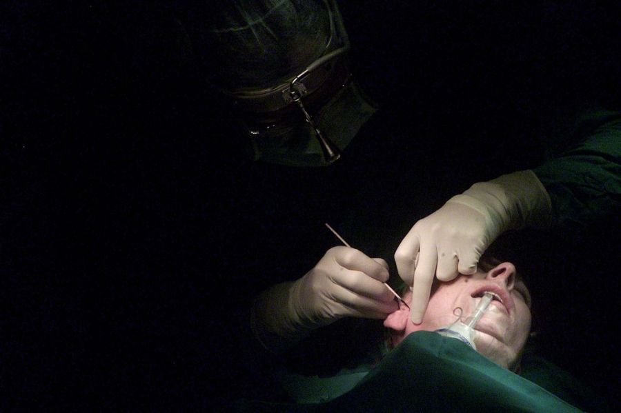 Bei einem Facelift wird die Haut im Gesicht aufgeschnitten, angehoben und anschliessend nach hinten gestrafft. (Symbolbild)