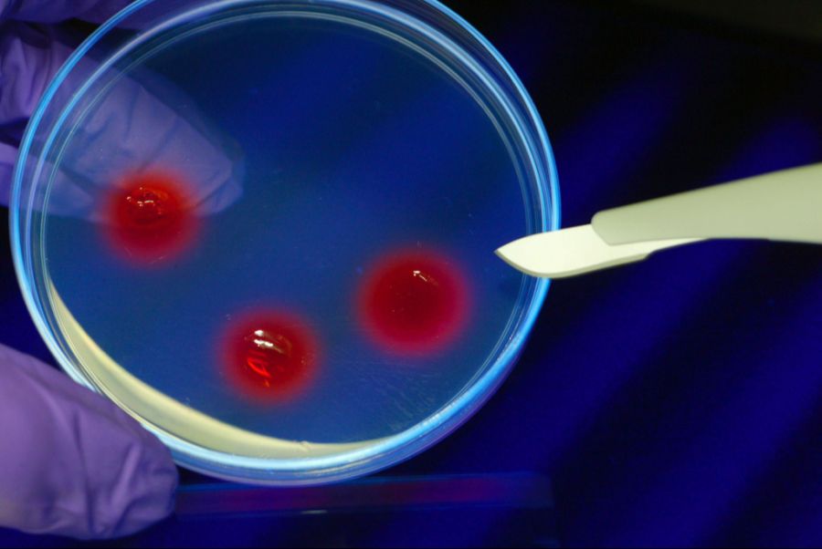 Der kleine Oliver, der unter dem Hunter-Syndrom leidet, wurde mit einer neuen Gentherapie behandelt. (Symbolbild)