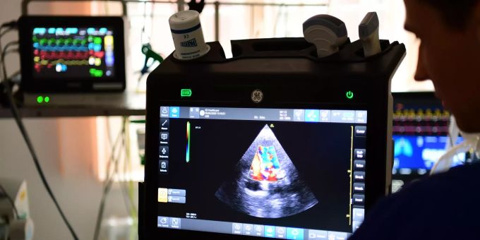 Ein Arzt untersucht im städtischen Klinikum Brandenburg das Herz eines Patienten mit Ultraschall. Herzmuskelentzündung Corona