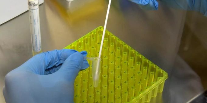Corona-Test im Labor. coronavirus