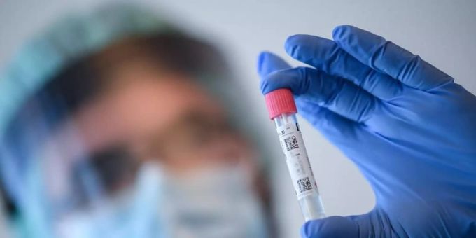 Ein Arzt nimmt in der Corona-Teststelle am Flughafen Schönefeld einen Abstrich für einen Coronavirus-Test. Coronavirus
