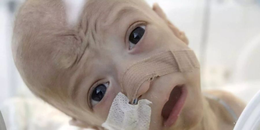 Ein rumänisches Baby auf der Intensivstation. EU-weit hat Rumänien neben Malta die höchste Säuglingsterblichkeitsrate. Bei einem EU-Durchschnitt von 3,6 - ungefähr wie in der Schweiz - liegt sie bei 6,7. (Archivbild)