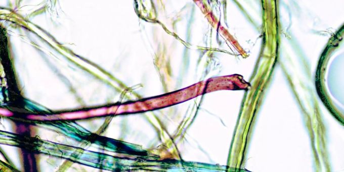 Gemäss einer kanadischen Studien nehmen Menschen unfreiwillig viel Mikroplastik zu sich. Mikroplastik