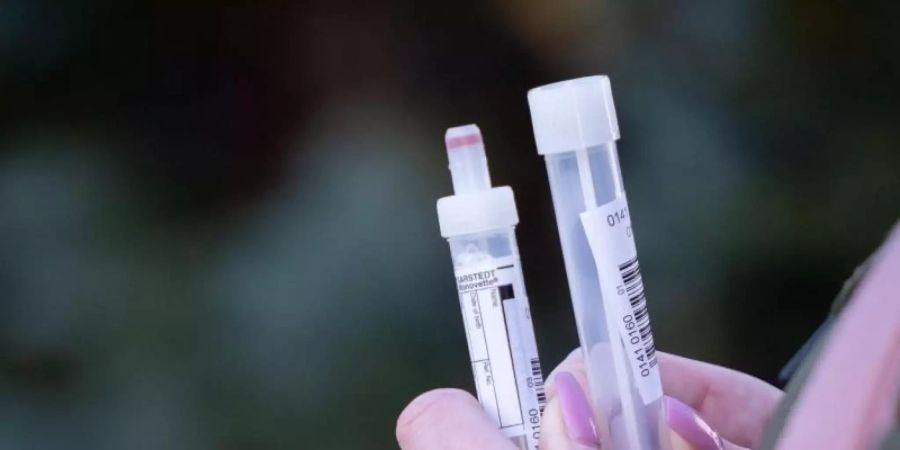 Eine steht wartend vor einem Zelt für den Coronatest in Berlin-Lübars mit Teströhrchen. Foto: Kay Nietfeld/dpa
