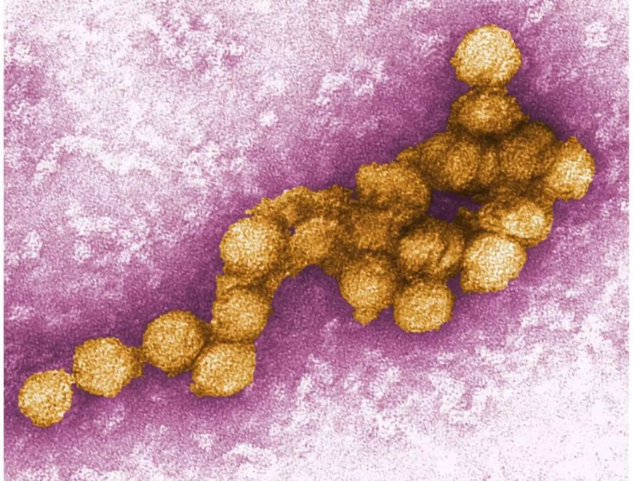 Eine elektronenmikroskopische Aufnahme des West-Nil-Virus.