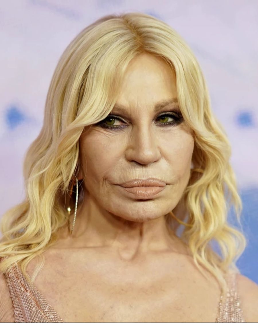 Zum Vergleich: So sah Donatella noch im März 2024 aus.