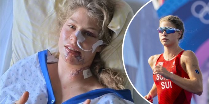 Horror-Sturz - Triathletin Schär: «Narben im Gesicht werden bleiben» Horror-Sturz - Triathletin Schär: «Narben im Gesicht werden bleiben»