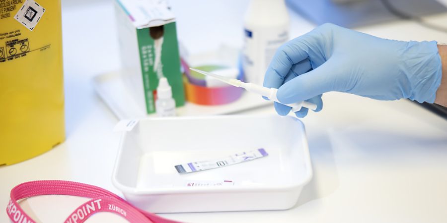 Die Stadt Zürich verstärkt den Kampf gegen Geschlechtskrankheiten. (Symbolbild)