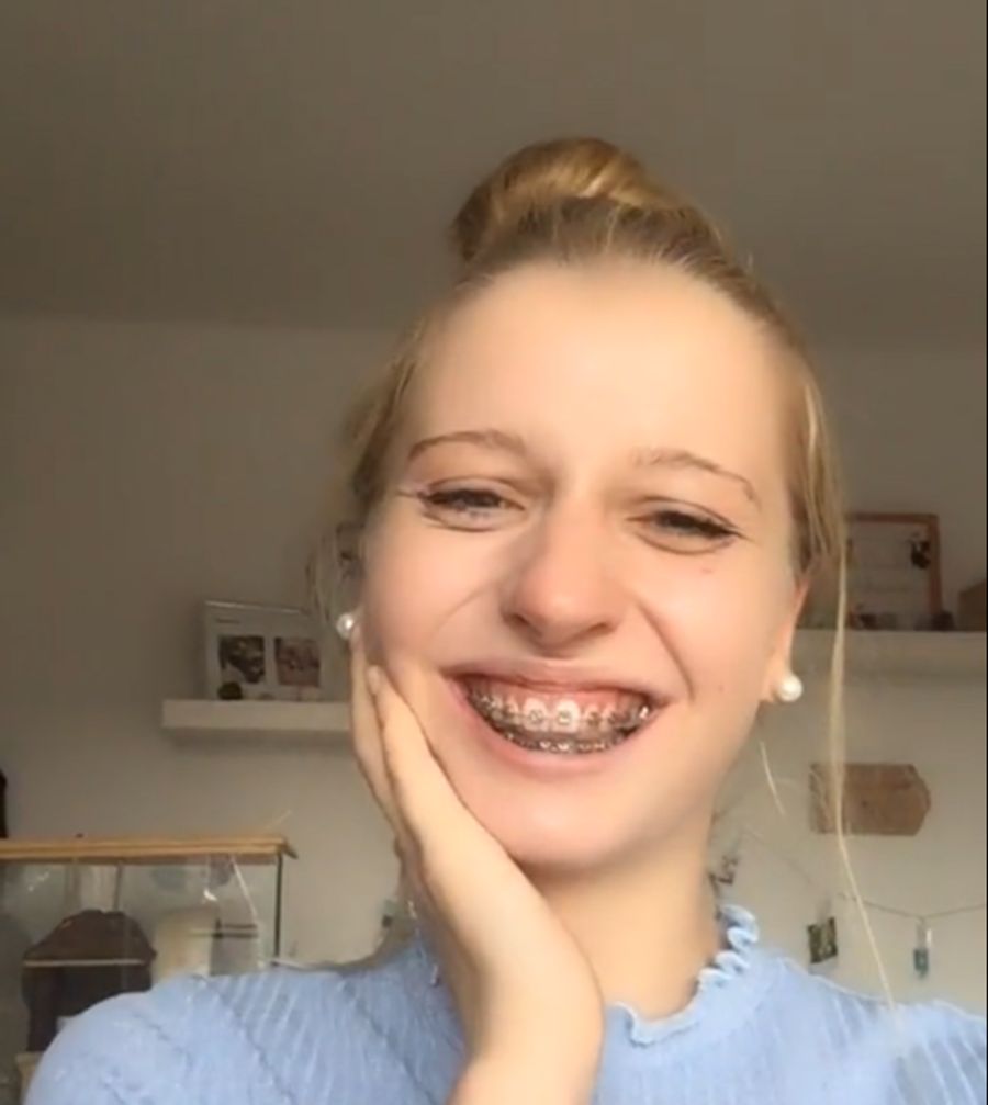 Zahnspange
