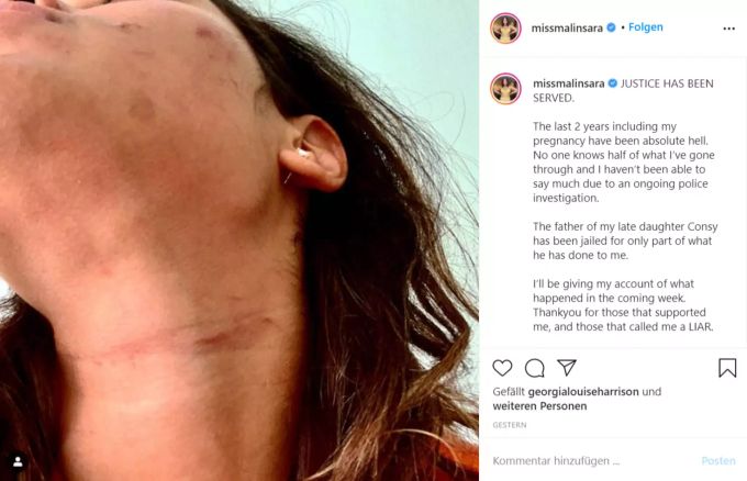 Dieses Bild veröffentlichte Malin Andersson auf ihrem Instagram-Kanal. Malin Andersson