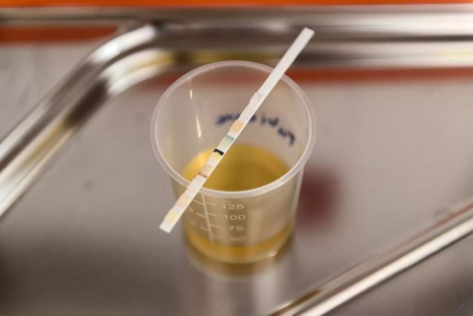 Urinprobe
