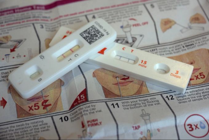 Eine Infektion mit dem Coronavirus kann langanhaltende Folgen haben. Corona