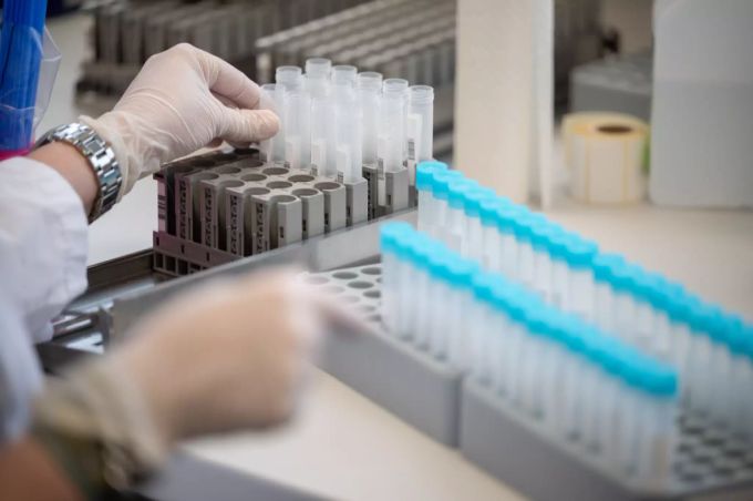 Gemäss Lauterbach könne man auch mit den aktuellen Schätzdaten Gesundheitspolitik machen. coronavirus