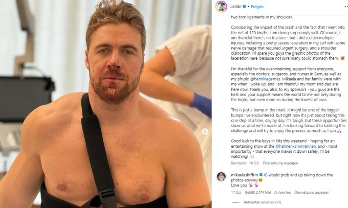 Aleksander Kilde meldet sich nach seinem Aufenthalt im Berner Inselspital zu Wort. Aleksander Kilde
