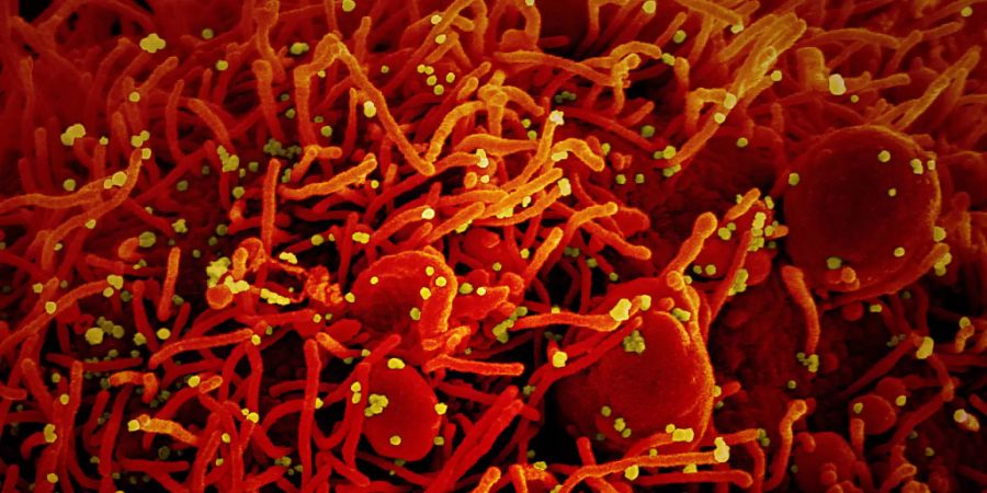 ARCHIV - Eine Zelle (rot) mit dem Coronavirus (SARS-CoV-2, gelb) infiziert. Foto: National Institute of Allergy and Infectious Diseases/Europa Press/dpa - ACHTUNG: Nur zur redaktionellen Verwendung und nur mit vollständiger Nennung des vorstehenden Credits