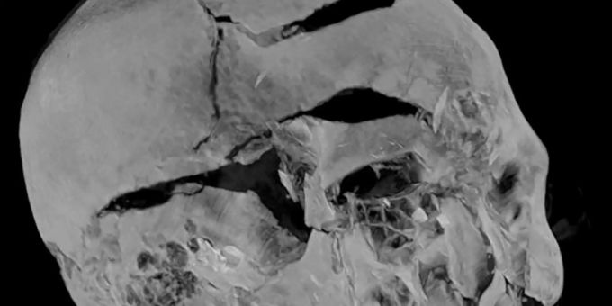 CT-Aufnahme der Mumie von Seqenenre CT-Aufnahme der Mumie von Seqenenre