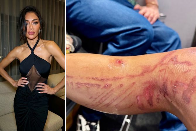 Nicole Scherzinger