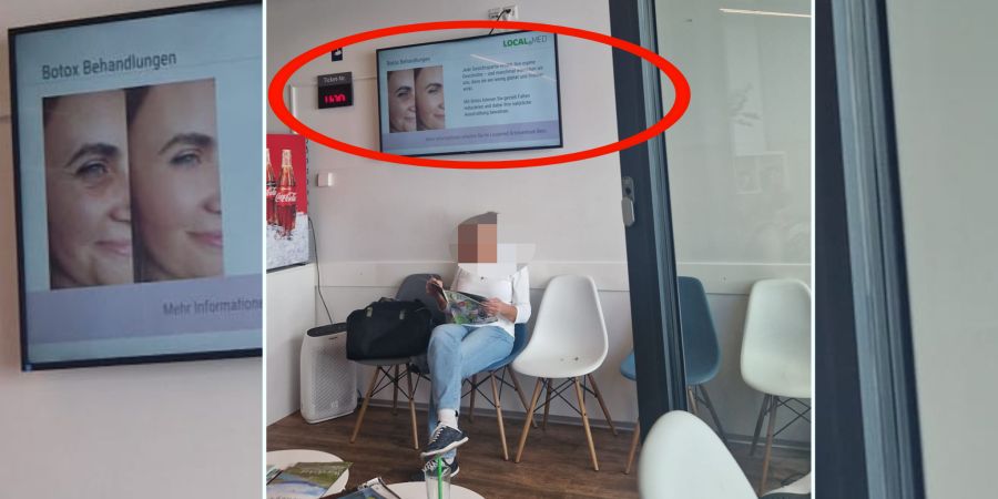 Botox Werbung city notfall