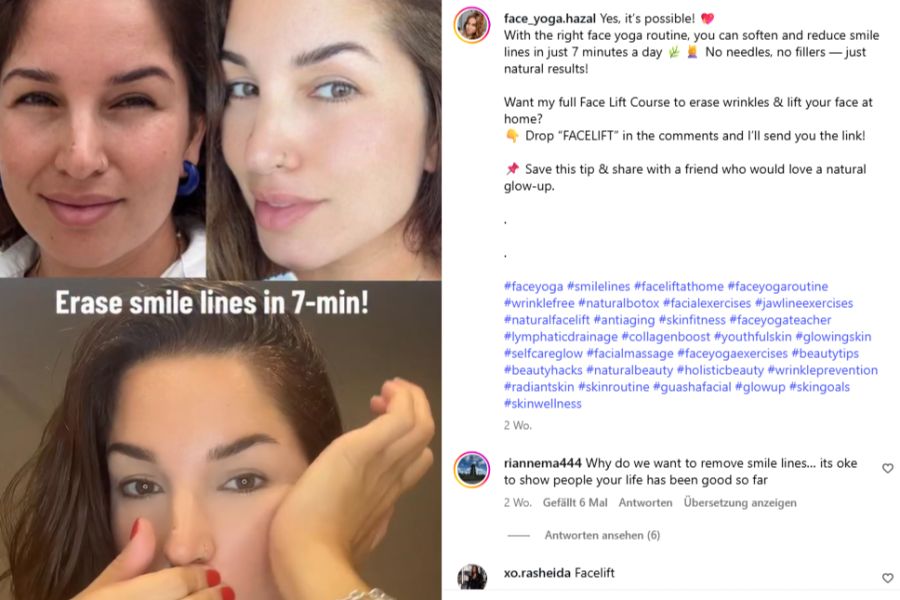 Die Gesichtsmassage-Techniken sollen laut unzähligen Influencern sichtbar Fältchen wegzaubern.