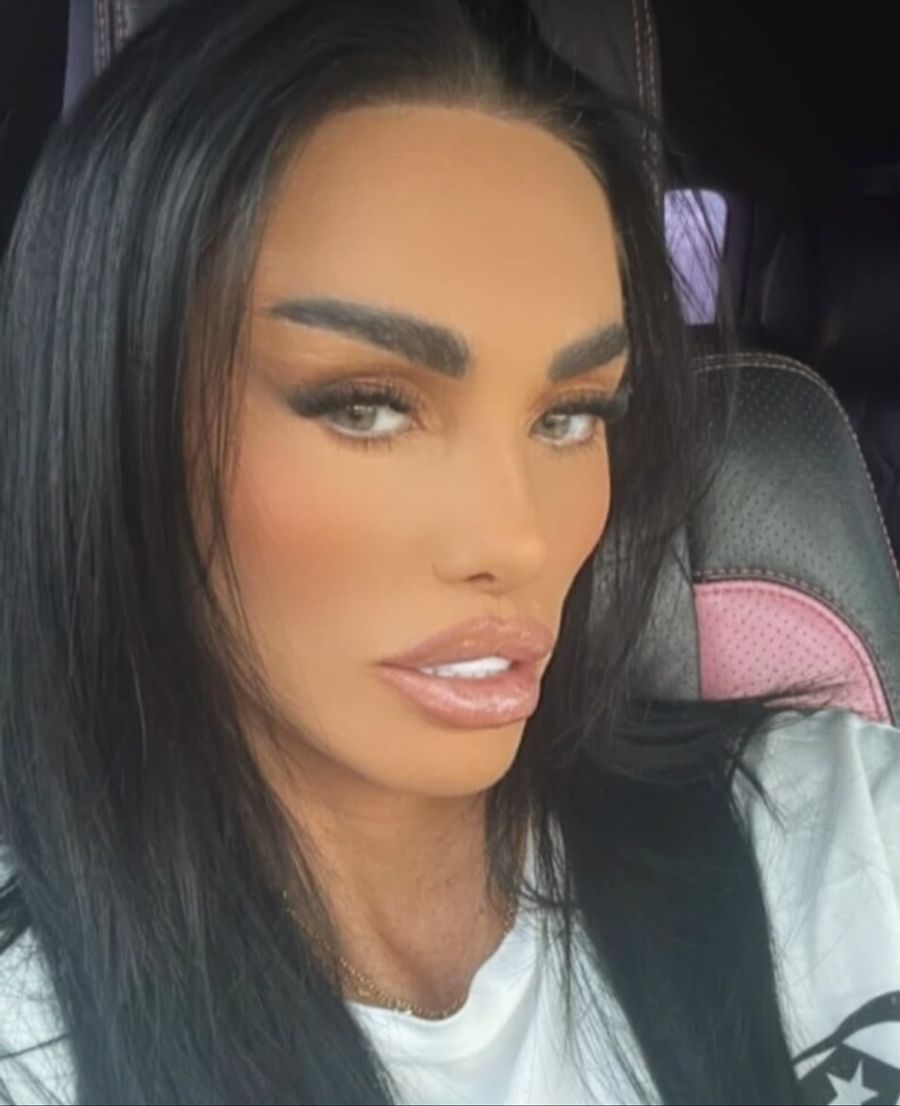 Katie Price hatte schon unzählige Beauty-Eingriffe.