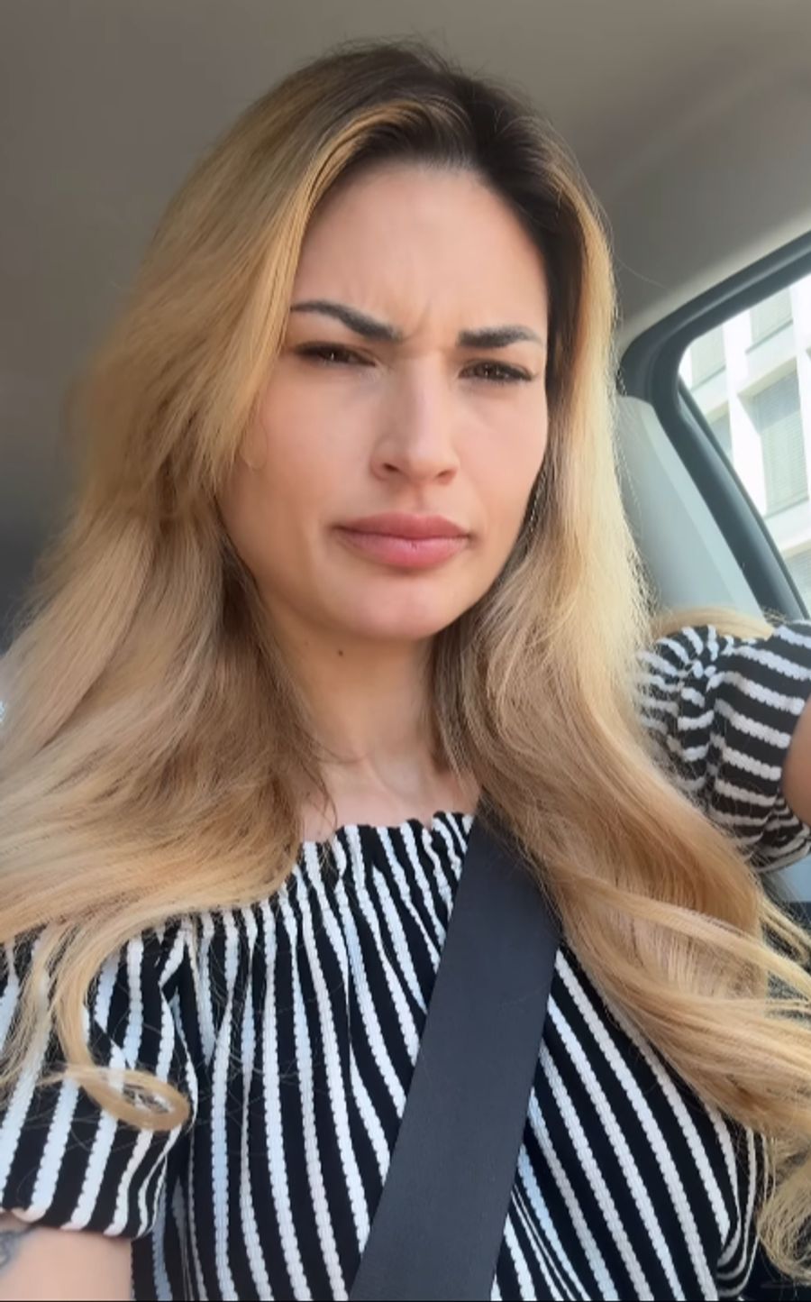 Larissa zeigt, wie sie vor der Botox-Behandlung ausgesehen hat.