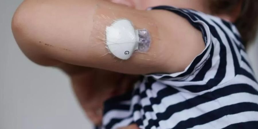 Solche chronischen Wunden können auch als Komplikation bei Diabetes auftreten und sind sehr hartnäckig.