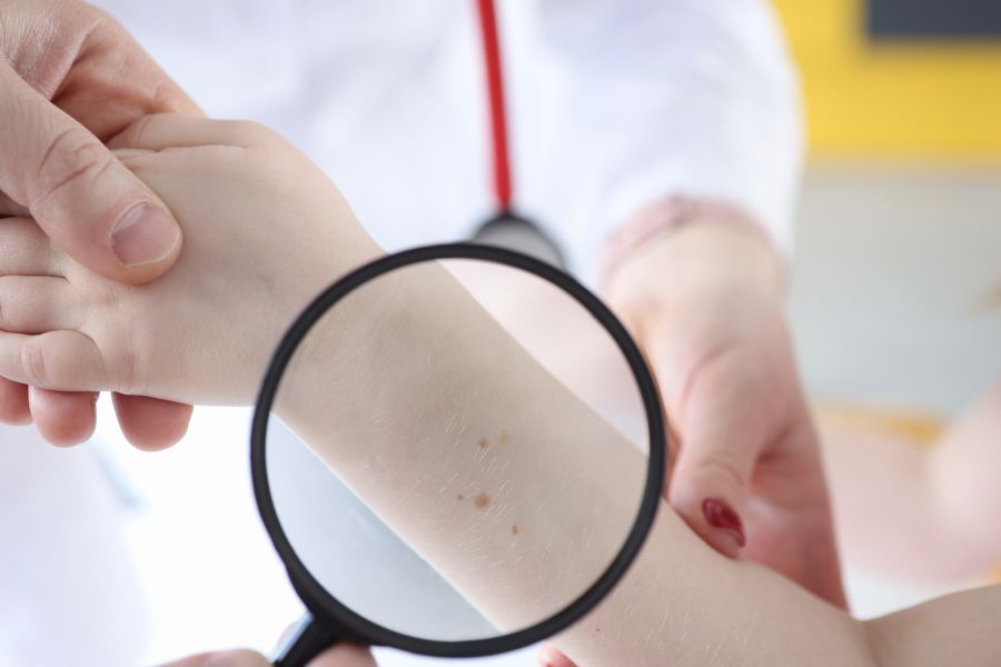Dermatologe schaut sich Muttermale eines Kindes auf seinem Arm an