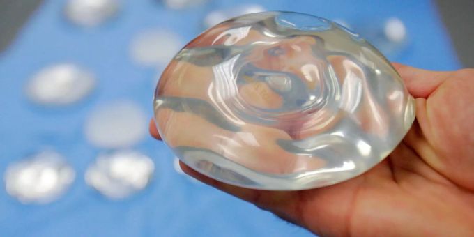 Ein Brustimplantat aus Silikon-Gel. brustimplantat