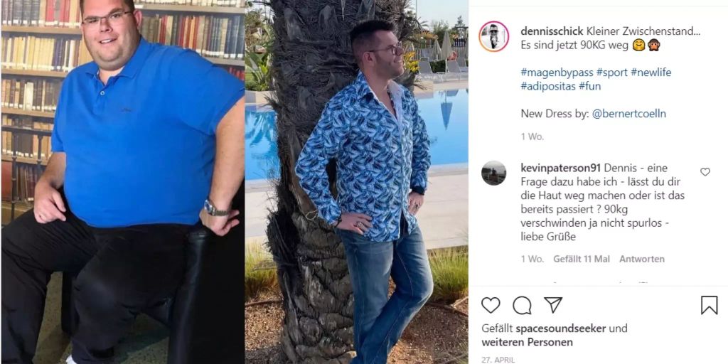 Reality Tv Dennis Schick Hat 90 Kilogramm Abgenommen