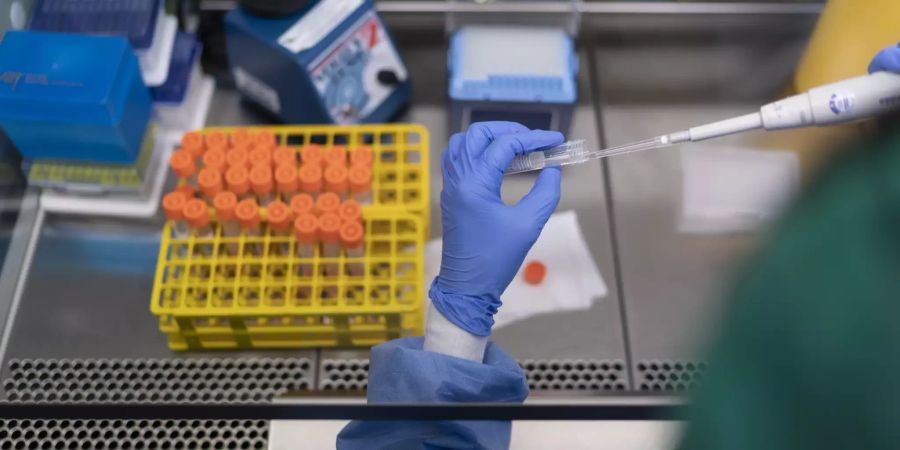 Pipettieren von Proben mit Coronavirus durch eine Labor-Mitarbeiterin im Stadtspital Triemli in Zürich.