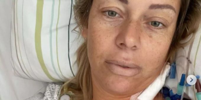 TV-Auswanderin - Julia Holz kommt bei Chemotherapie an ihre Grenzen