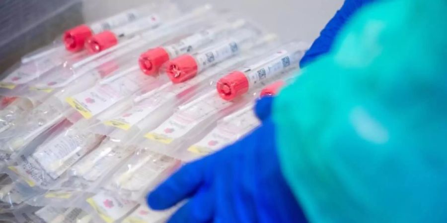 In der Fussball-Bundesliga werden die Spieler regelmässig auf das Coronavirus getestet. Foto: Jens Büttner/dpa-Zentralbild/dpa