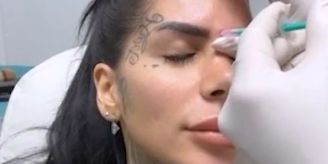 «Will keine Mimik» - Hier spritzt sich Mia Madisson die Stirn glatt «Will keine Mimik» - Hier spritzt sich Mia Madisson die Stirn glatt