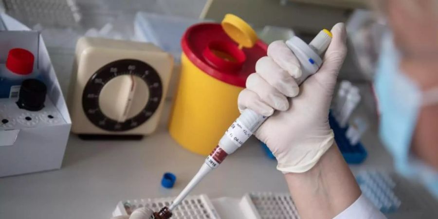 Lediglich 1,3 Prozent der untersuchten Blutspender trägt bereits Antikörper gegen das neuartige Coronavirus in sich. Das ergaben Untersuchungen des RKI. Foto: Marijan Murat/dpa