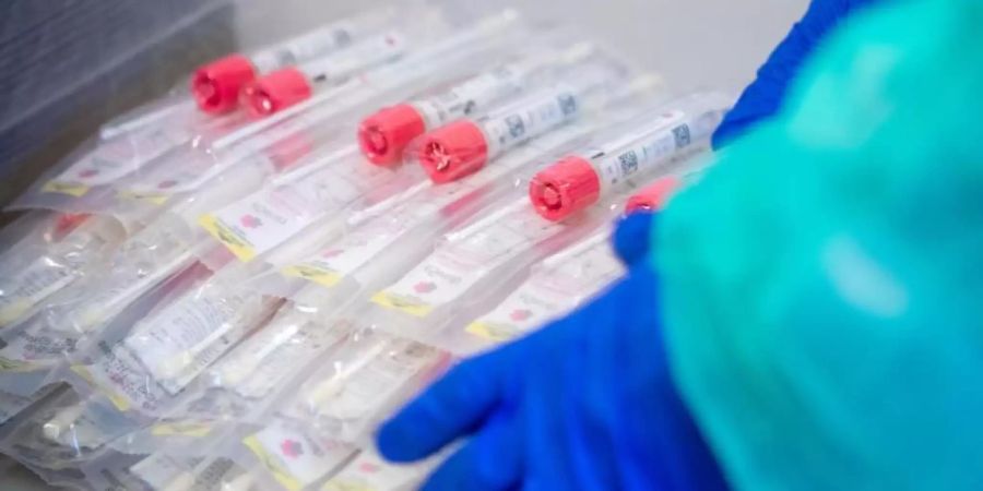 In der Fussball-Bundesliga und der 2. Liga sollen die flächendeckenden Tests auf das Coronavirus beginnen. Foto: Jens Büttner/dpa-Zentralbild/dpa