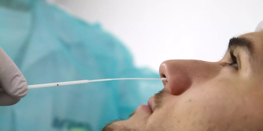 Kostenpflichtige Coronatests für Personen ohne Symptome und verschärfte Auflagen für Schnelltester drücken die Zahl der Tests. (Archivbild)