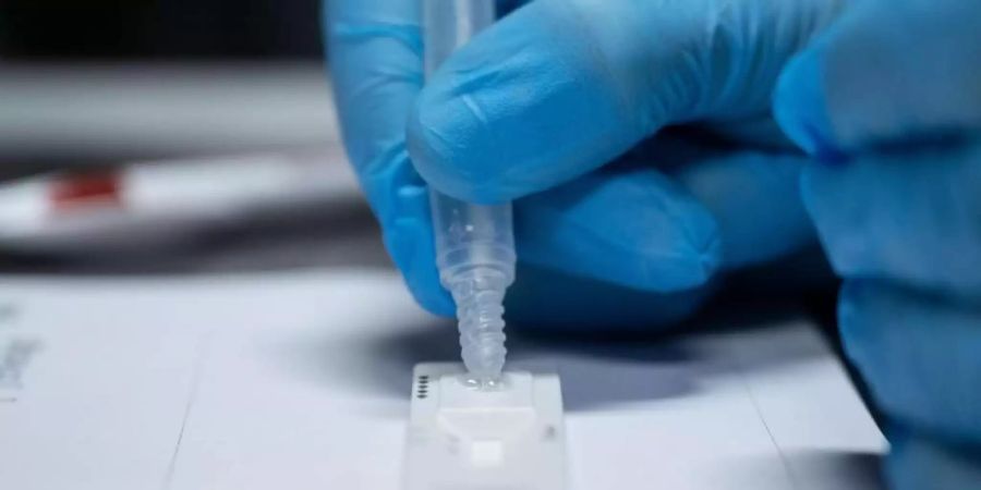 Für Kinder in Schulen und Kitas soll die Quarantäne als Kontaktperson fünf Tage dauern, mit abschliessendem PCR- oder Schnelltest. Foto: Marijan Murat/dpa