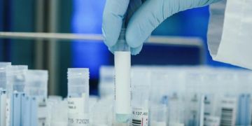 PCR-Tests