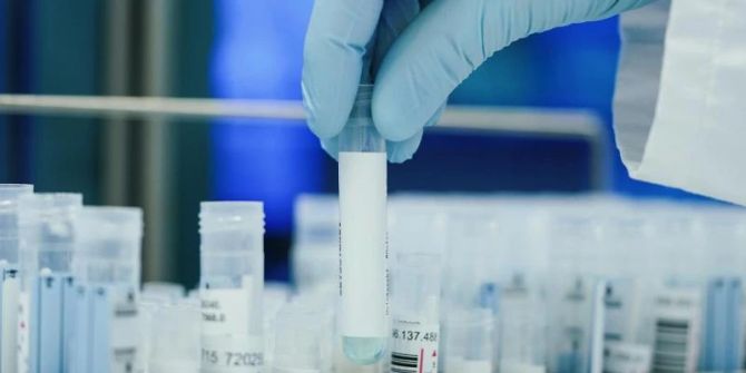 PCR-Tests