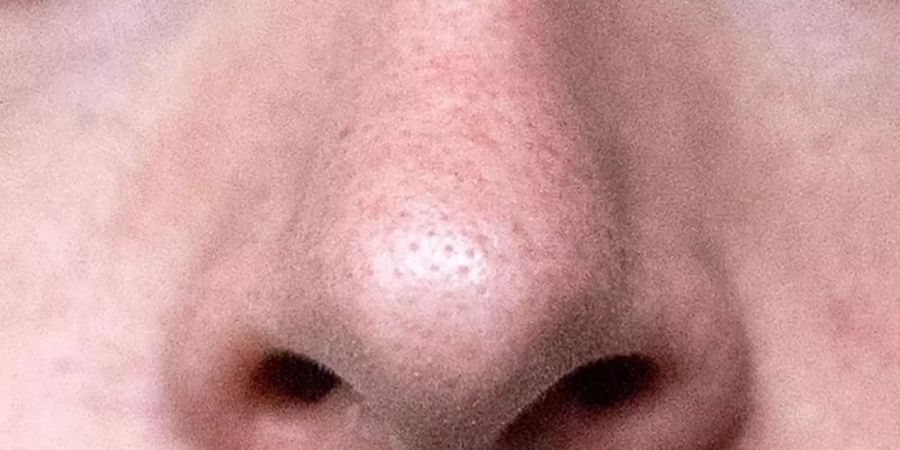 nase