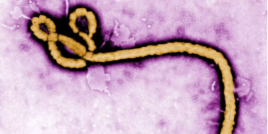 Das Ebola-Virus gehört zu den gefährlichsten Krankheitserregern der Welt.