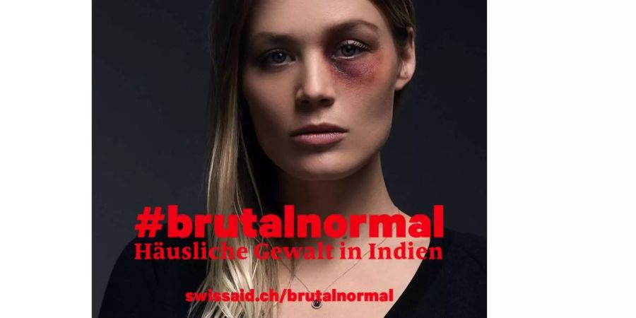 Dominique Rinderknecht setzt sich mit der Swissaid-Kampagne #brutalnormal gegen häusliche Gewalt ein.