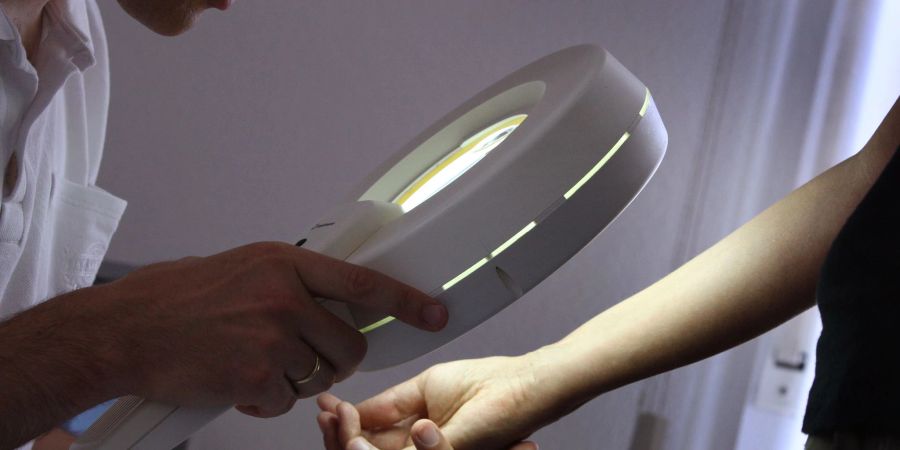 Bei der Hautkrebs-Früherkennung wird beim Dermatologen mit einem Vergrösserungsglas die Haut nach Veränderungen abgesucht.