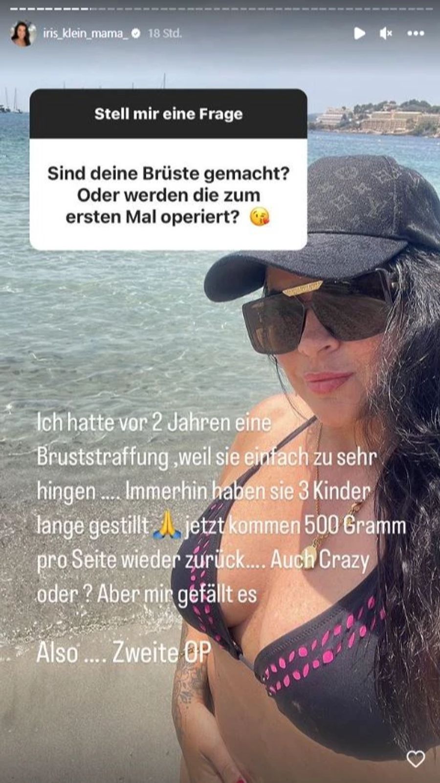 Die Mama von Daniela Katzenberger bekommt 500 Gramm Silikon pro Seite.